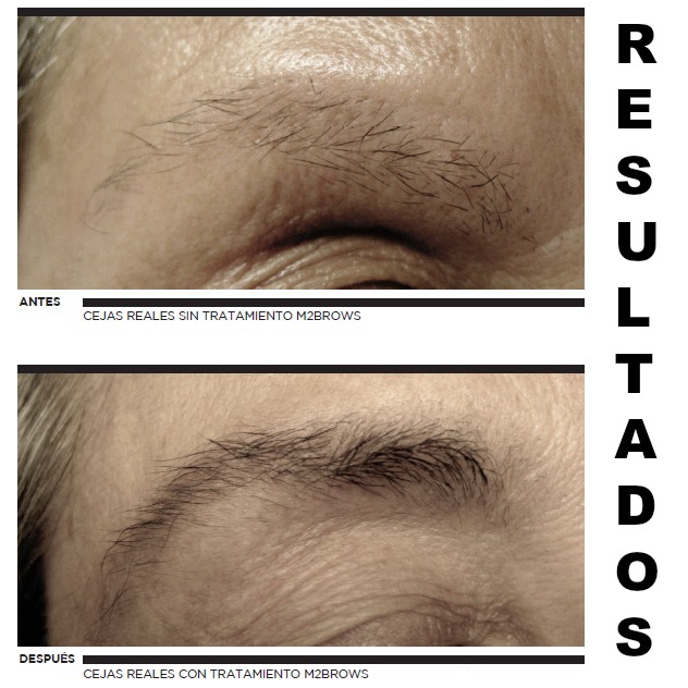 resultados m2 brows beauté